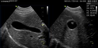 Jakie choroby może wykryć badanie USG?