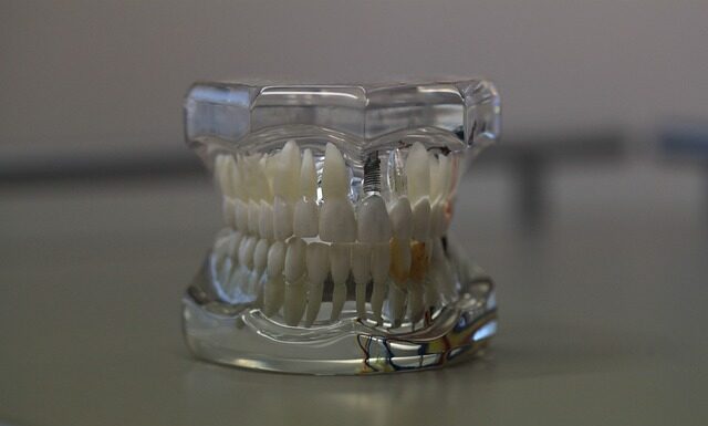 Jak Gryźć w protezie?