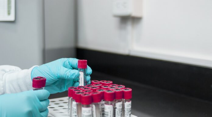 Inhibitory proteaz w warunkach laboratoryjnych – najważniejsze informacje Inhibitory proteaz w warunkach laboratoryjnych