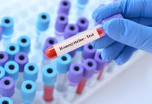 Homocysteina: Ukryte ryzyko dla Twojego serca i mózgu Homocysteina