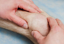 Jakie produkty przyspieszają gojenie ran